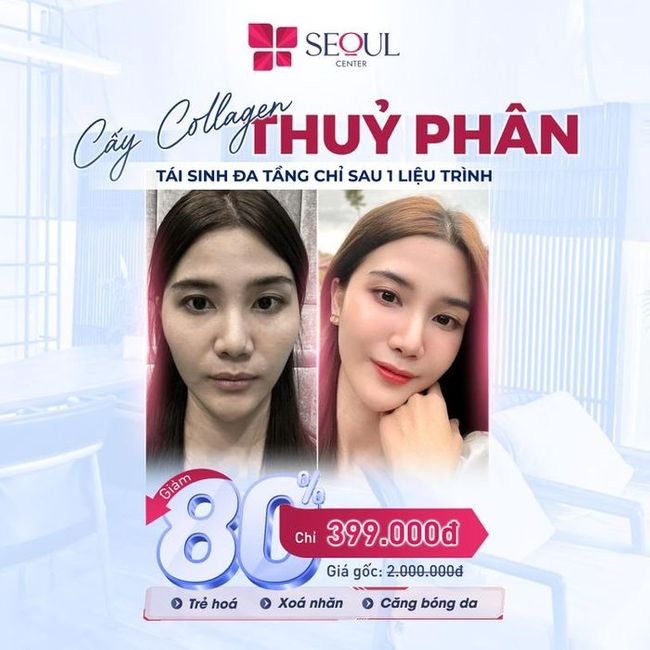 Miễn Phí Tư Vấn